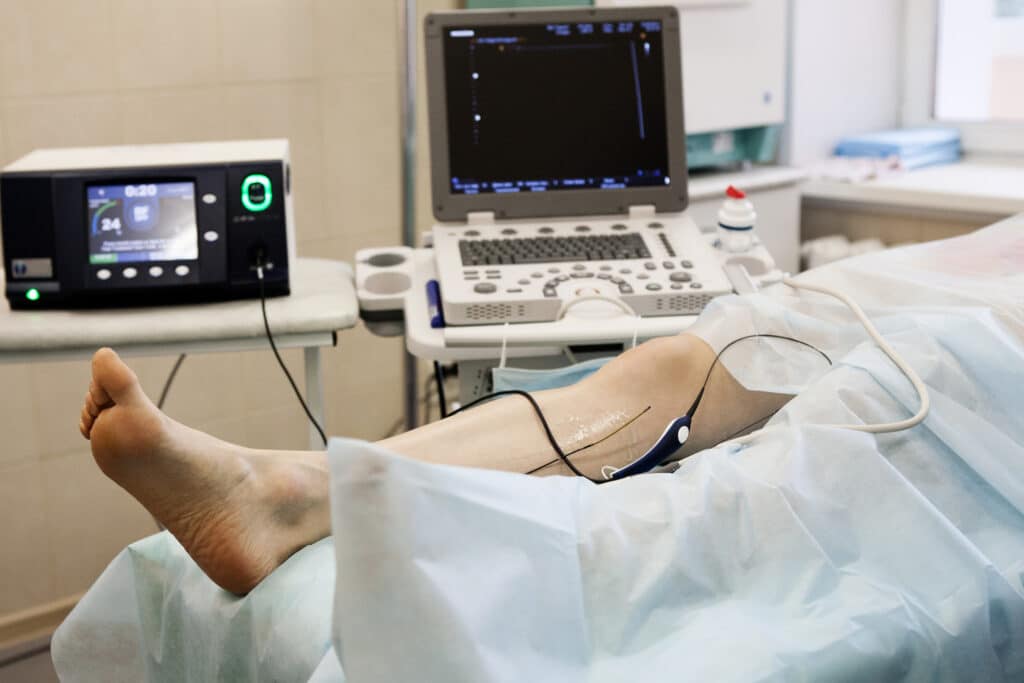 Vein Mapping / Reflux Studies in New Braunfels, TX