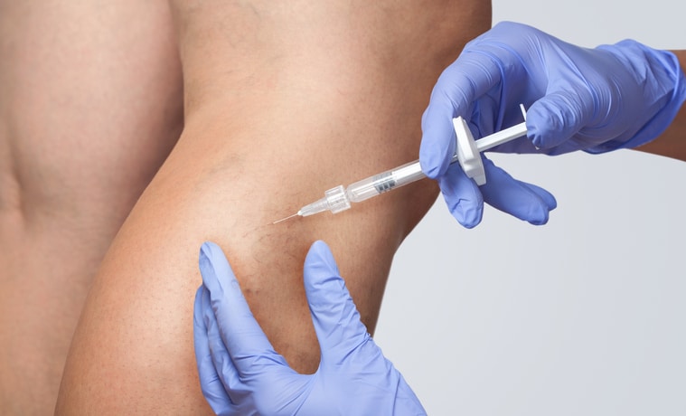 Visual Sclerotherapy in New Braunfels, TX